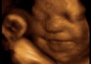 Bebês praticam choro dentro do útero, diz estudo